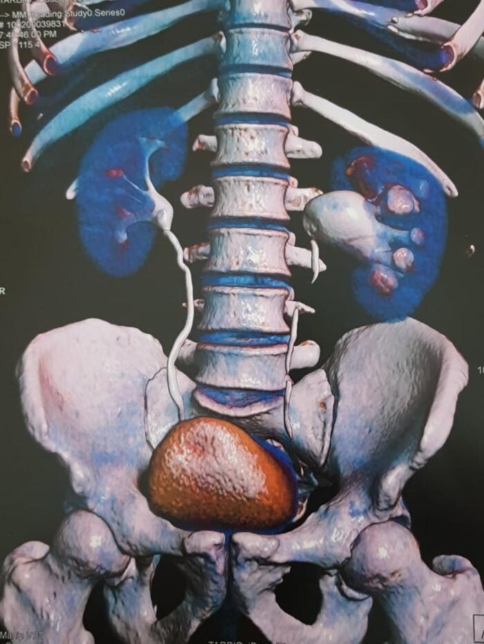 Images Urología Dr Koll y Dra Estefano