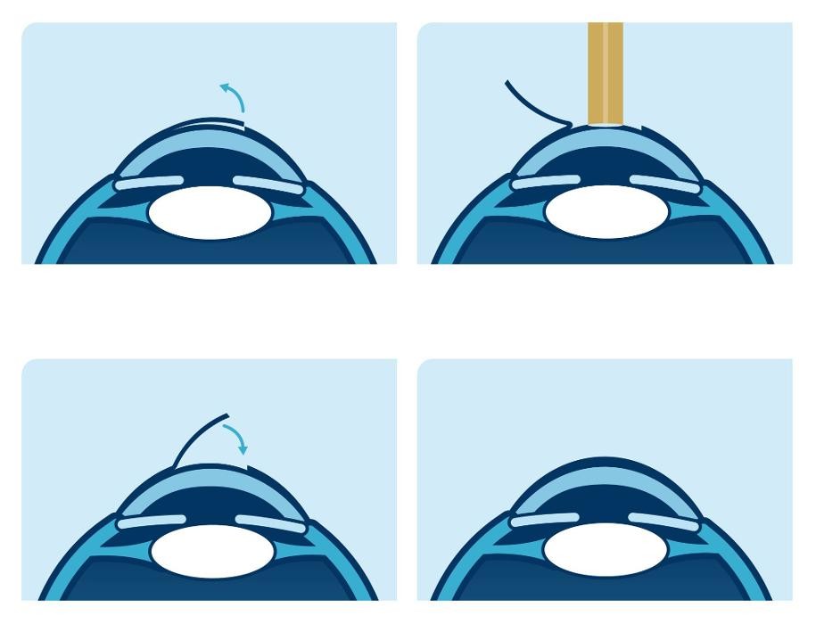 Bilder Oculovision Bregenz GmbH