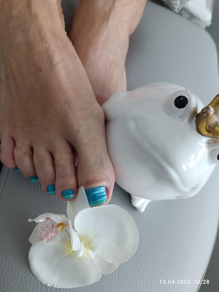Bilder Silvia Jann Kosmetik und podologische Fußpflege-Praxis-Microneedling RF-Hifu
