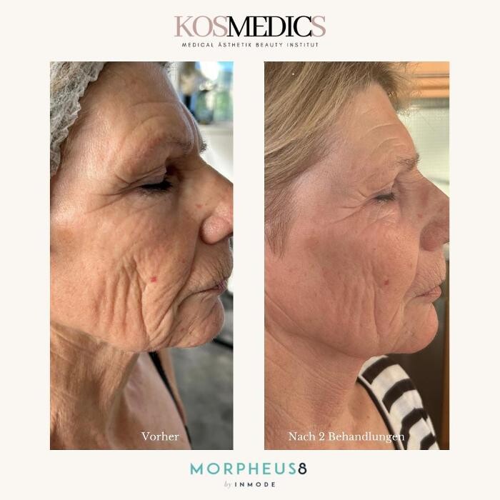 Bilder Kosmedics Institut