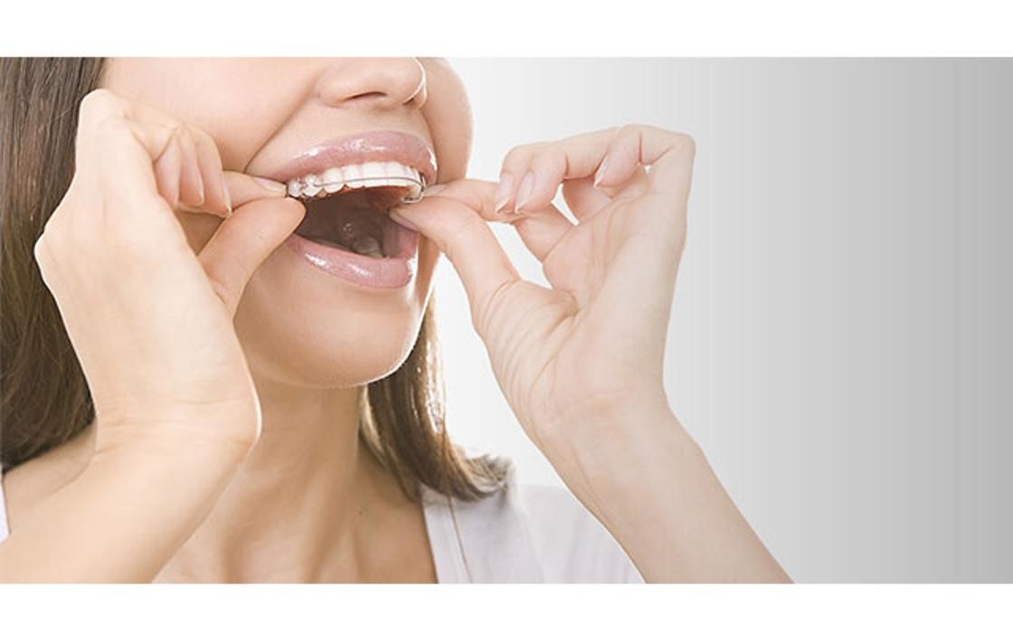 Images Adelaide Orthodontists