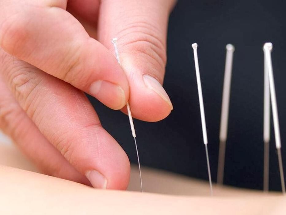 Images Wellbeing Chiropractic Hornsby - Chiropractor and Acupuncture