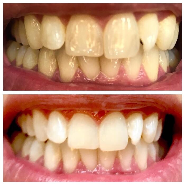 Images Complete Dental Care