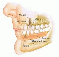 Images Caring Dentists