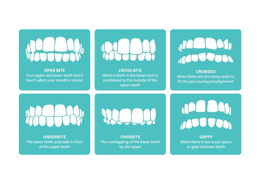 Images National Dental Care Frankston