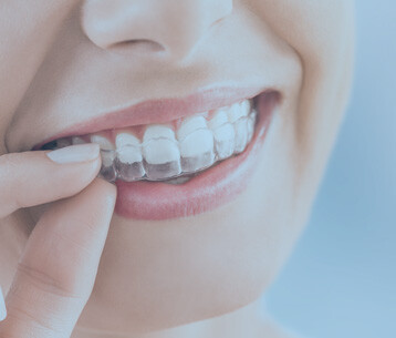 Images Elite Dental Adelaide