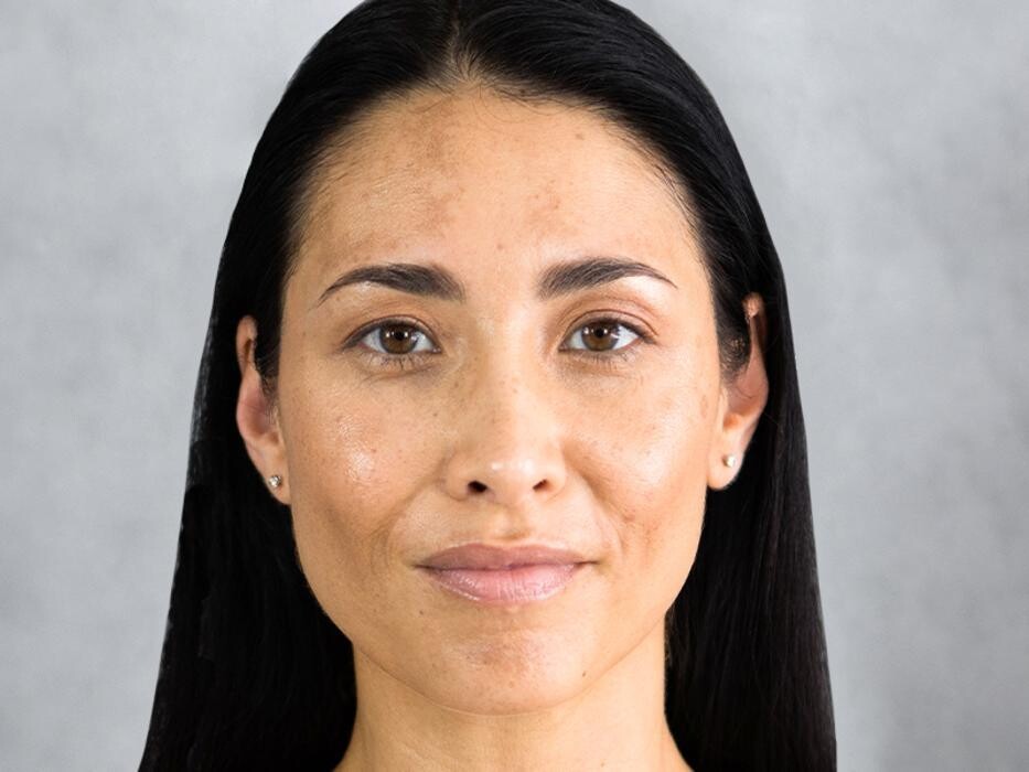 Images Results Laser Clinic Wollongong