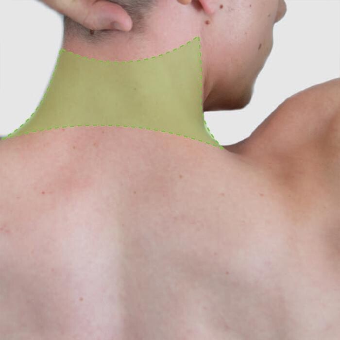 Images Results Laser Clinic Wollongong