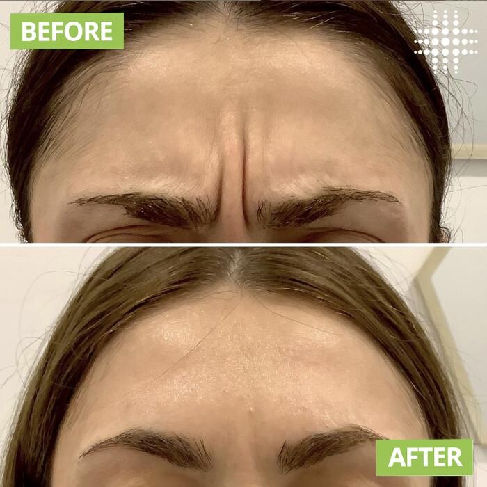 Images Results Laser Werribee