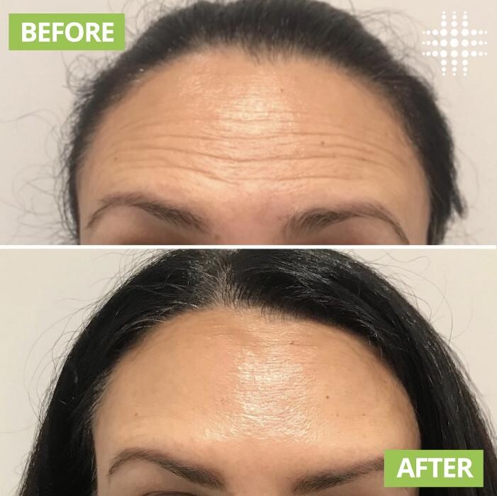 Images Results Laser Werribee