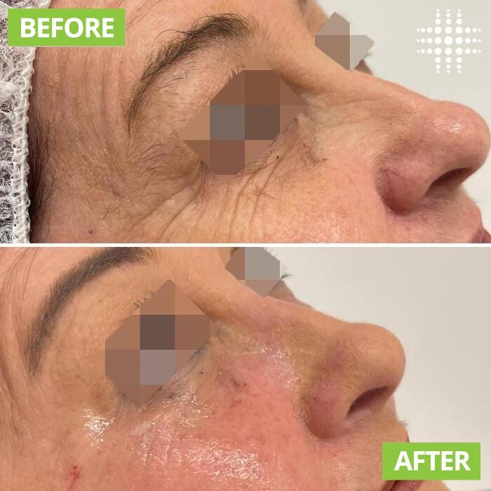 Images Results Laser Clinic Blacktown