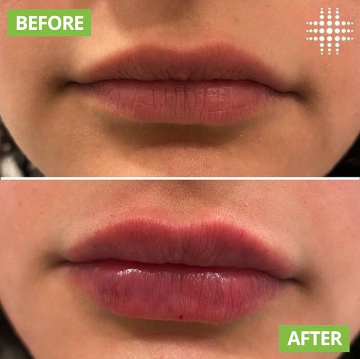 Images Results Laser Clinic Blacktown