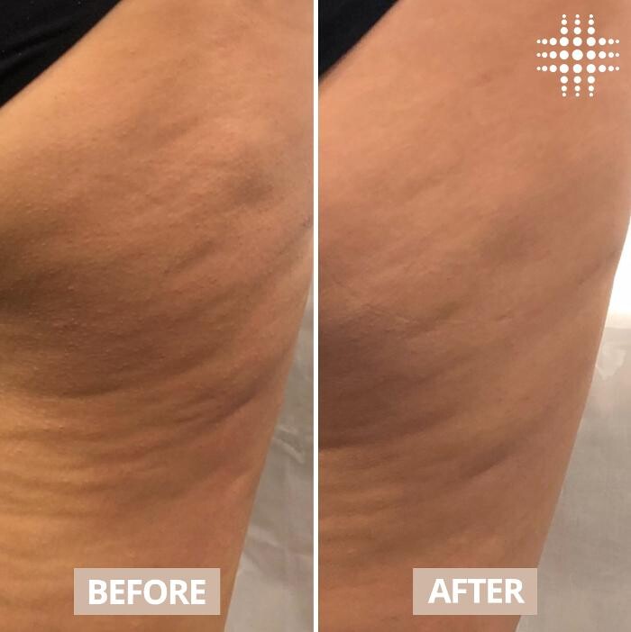 Images Results Laser Clinic Blacktown