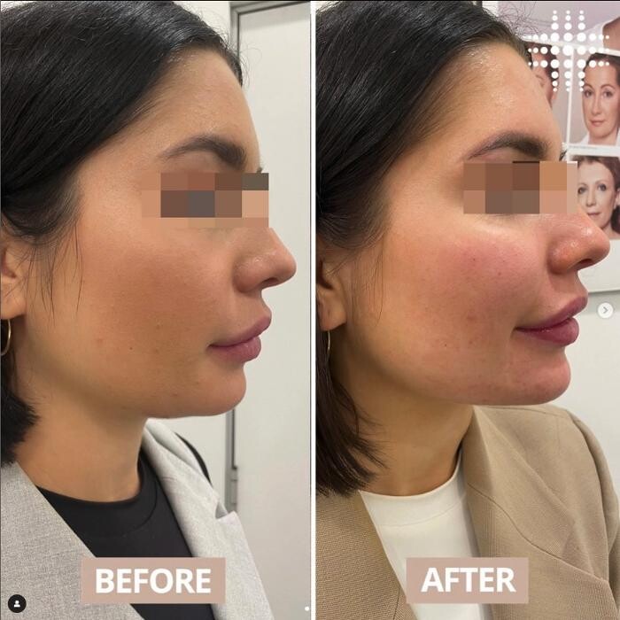 Images Results Laser Clinic Blacktown