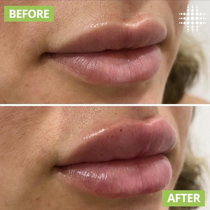 Images Results Laser Clinic Blacktown