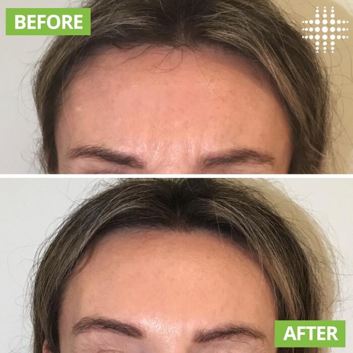 Images Results Laser Clinic Blacktown