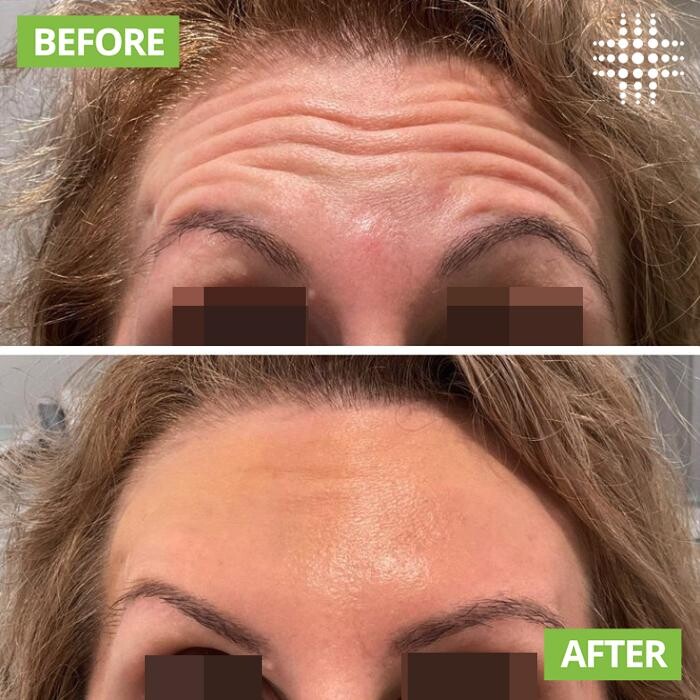 Images Results Laser Clinic Blacktown
