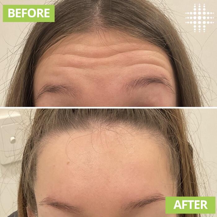 Images Results Laser Clinic Blacktown