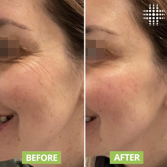 Images Results Laser Clinic Blacktown