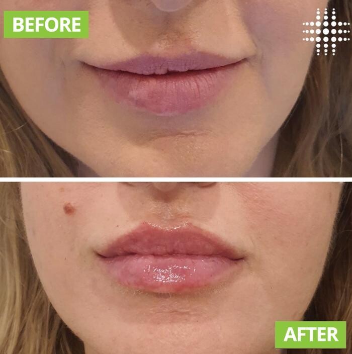 Images Results Laser Clinic Blacktown