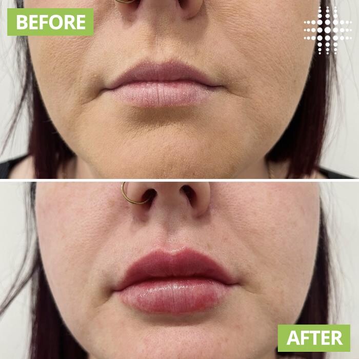 Images Results Laser Clinic Blacktown