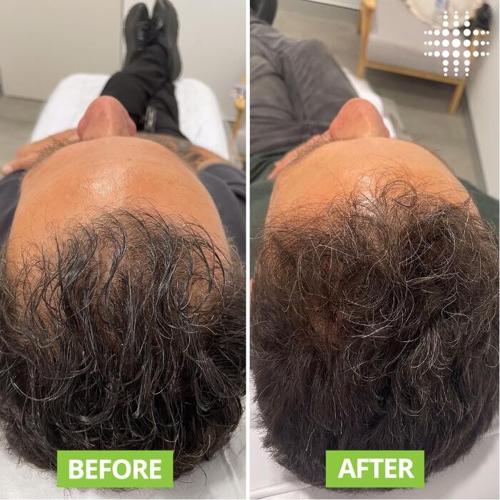 Images Results Laser Clinic Blacktown