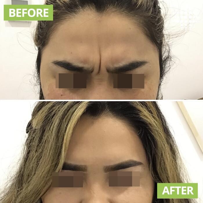 Images Results Laser Clinic Blacktown