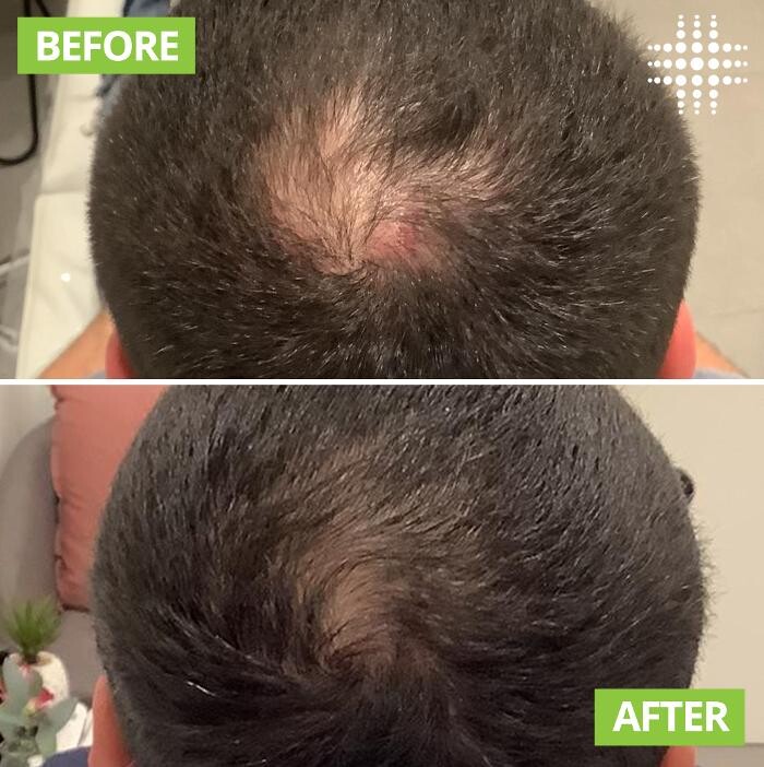 Images Results Laser Clinic Blacktown