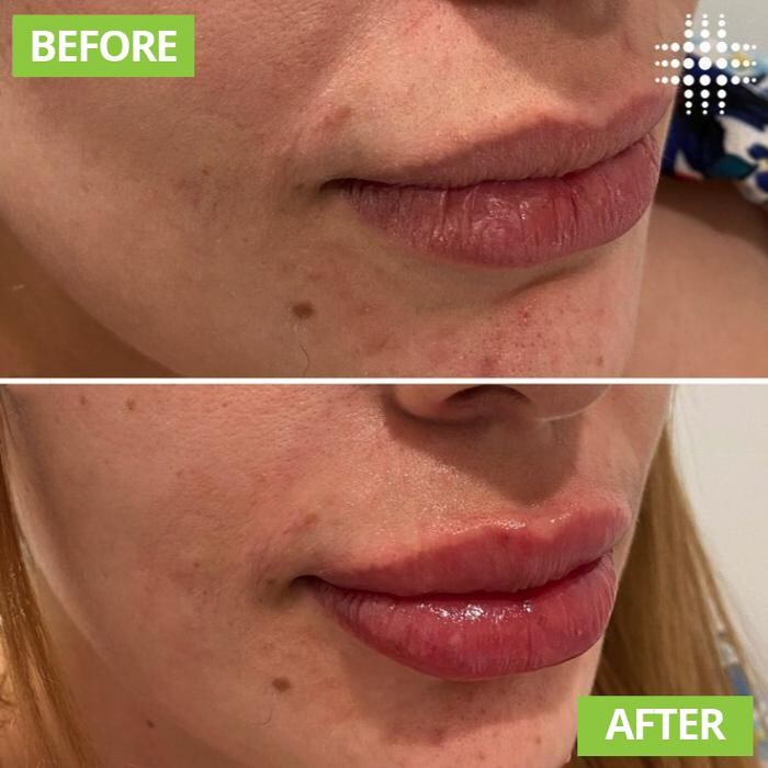 Images Results Laser Clinic Blacktown
