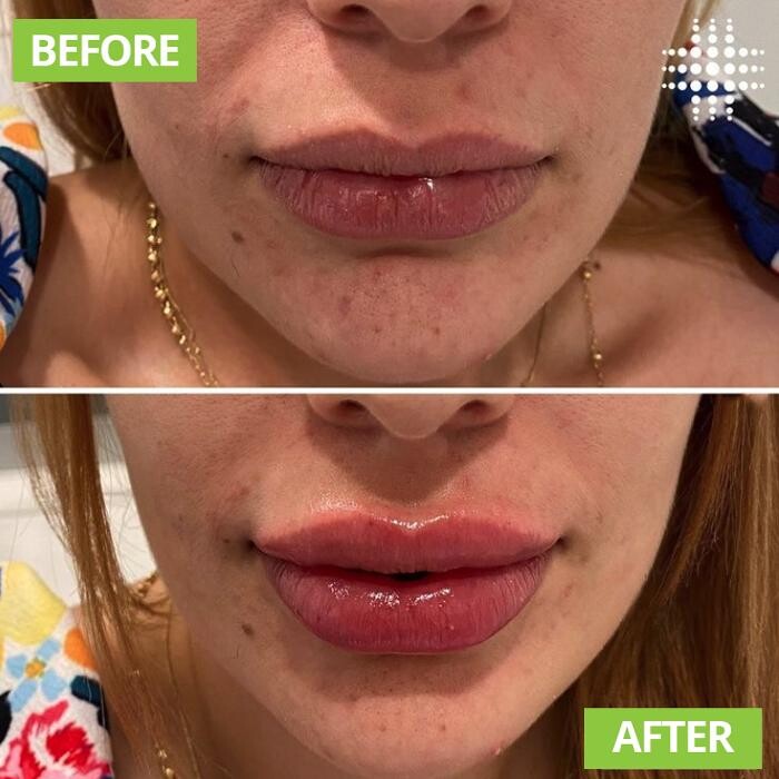 Images Results Laser Clinic Blacktown