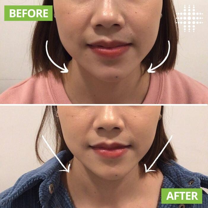 Images Results Laser Clinic Blacktown