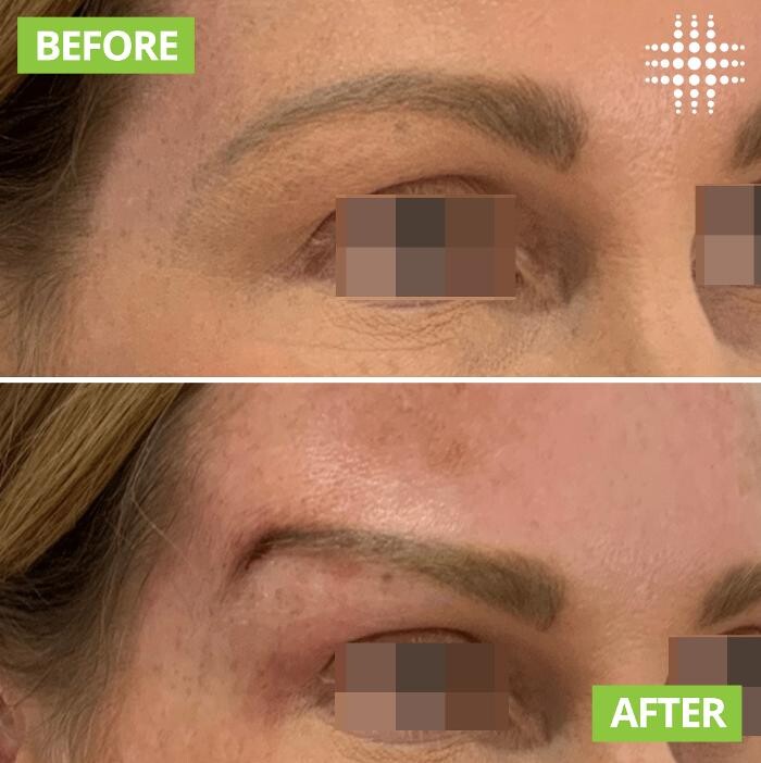 Images Results Laser Clinic Blacktown