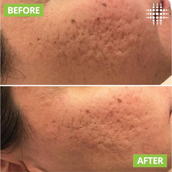 Images Results Laser Clinic Blacktown