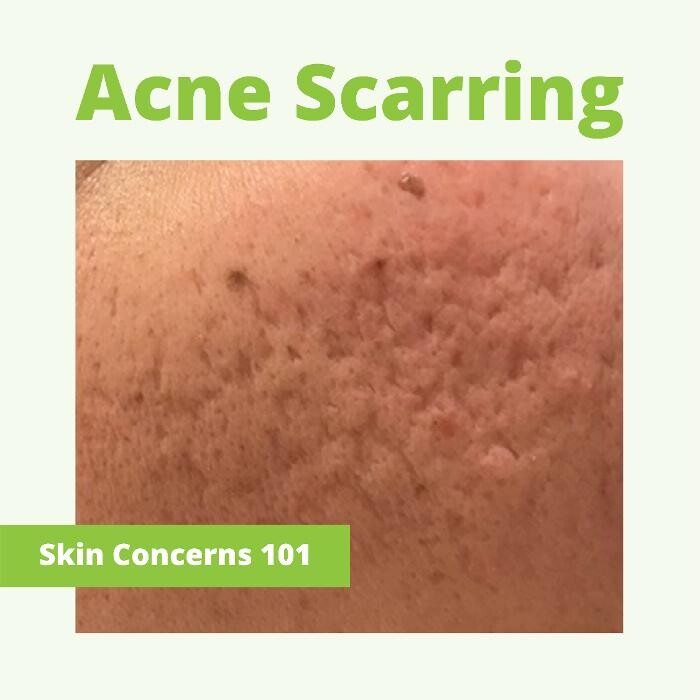 Images Results Laser Clinic Blacktown