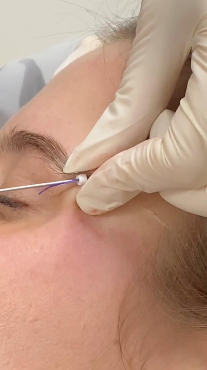 Images Results Laser Clinic Blacktown