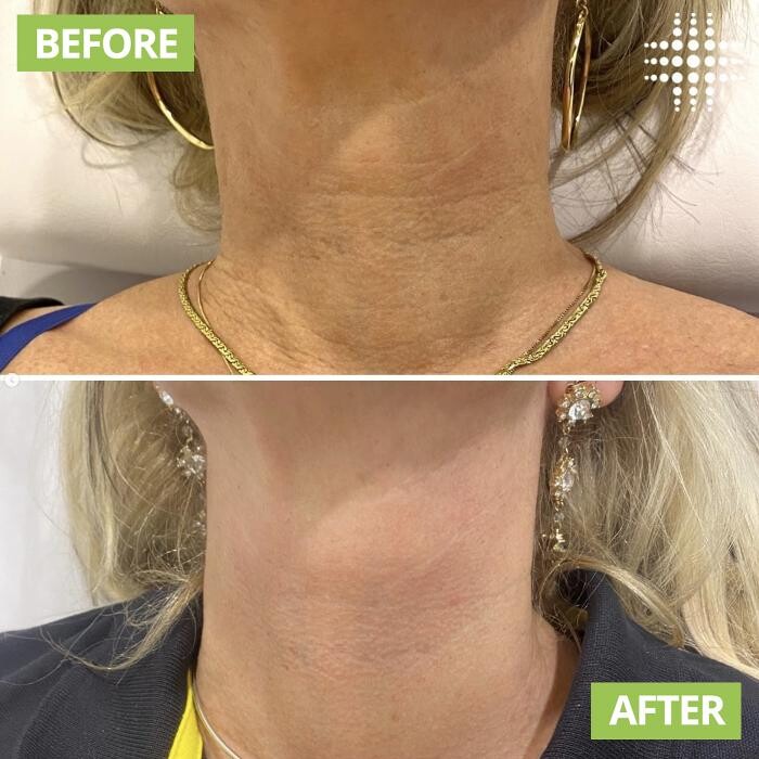 Images Results Laser Clinic Blacktown