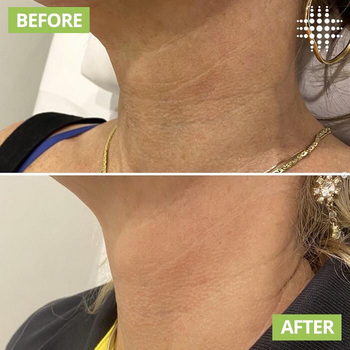 Images Results Laser Clinic Blacktown