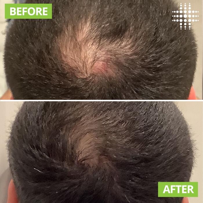 Images Results Laser Clinic Blacktown