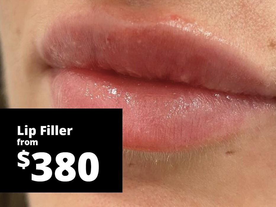 Images Results Laser Clinic Blacktown