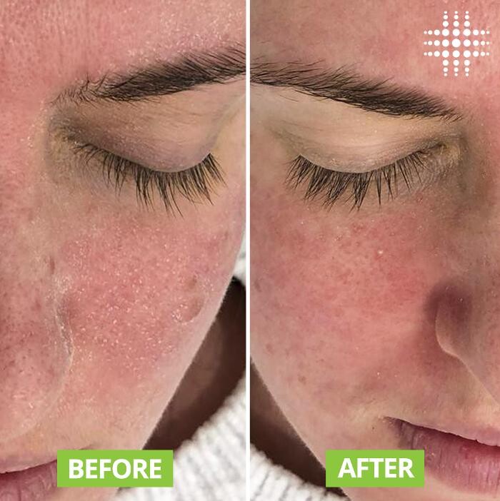 Images Results Laser Clinic Blacktown