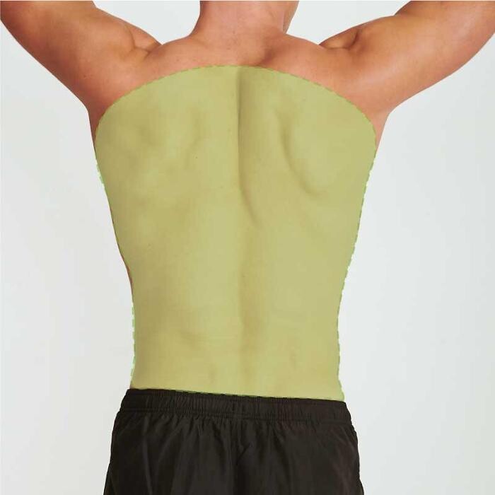 Images Results Laser Clinic Blacktown