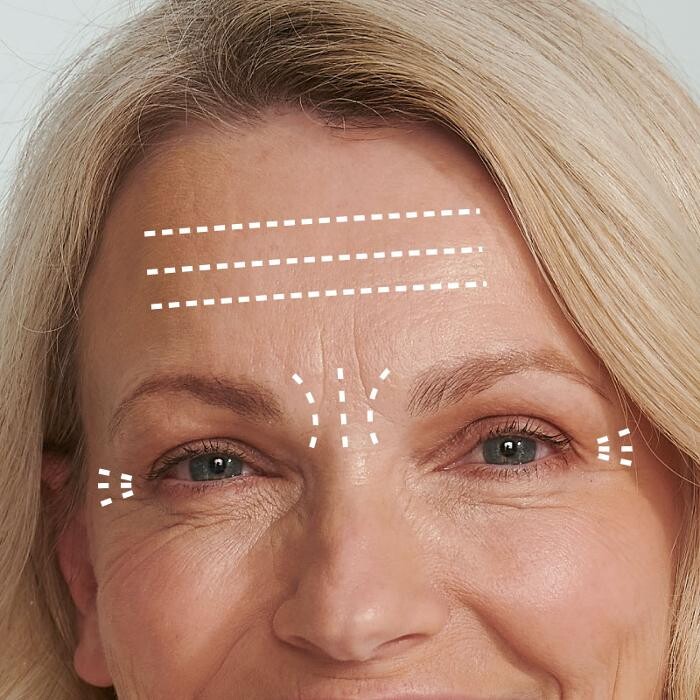 Images Results Laser Clinic Blacktown