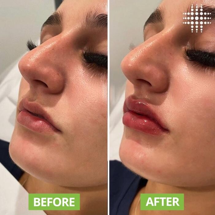 Images Results Laser Clinic Blacktown