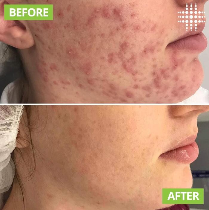 Images Results Laser Clinic Blacktown