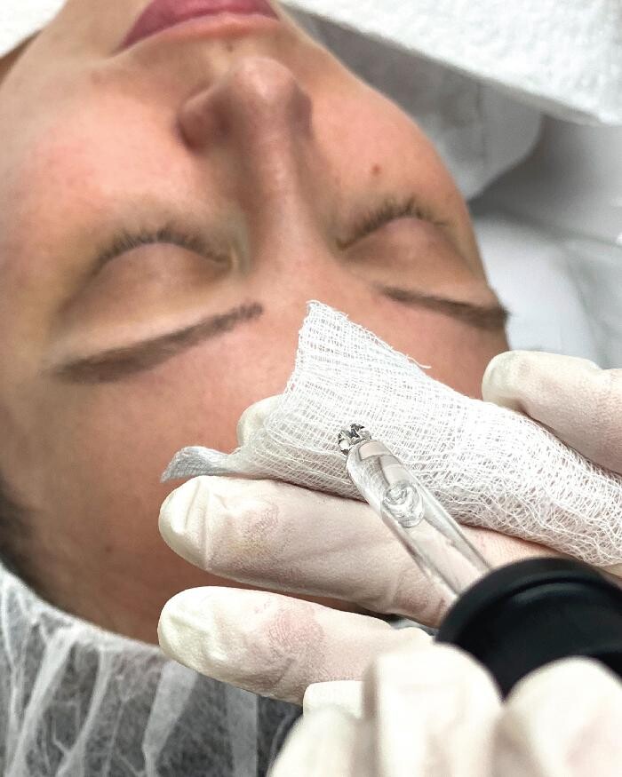 Images Results Laser Clinic Blacktown