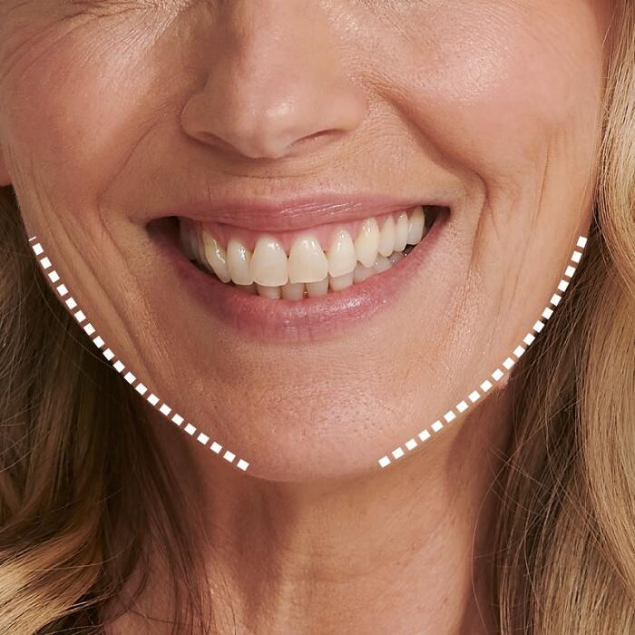 Images Results Laser Clinic Blacktown