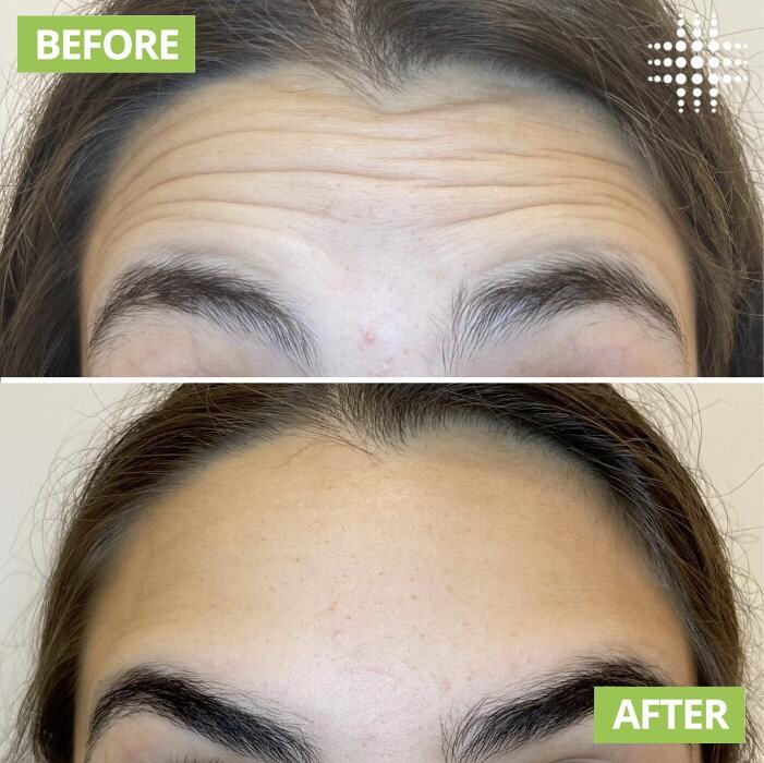 Images Results Laser Clinic Blacktown