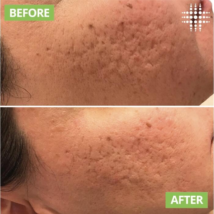 Images Results Laser Clinic Blacktown