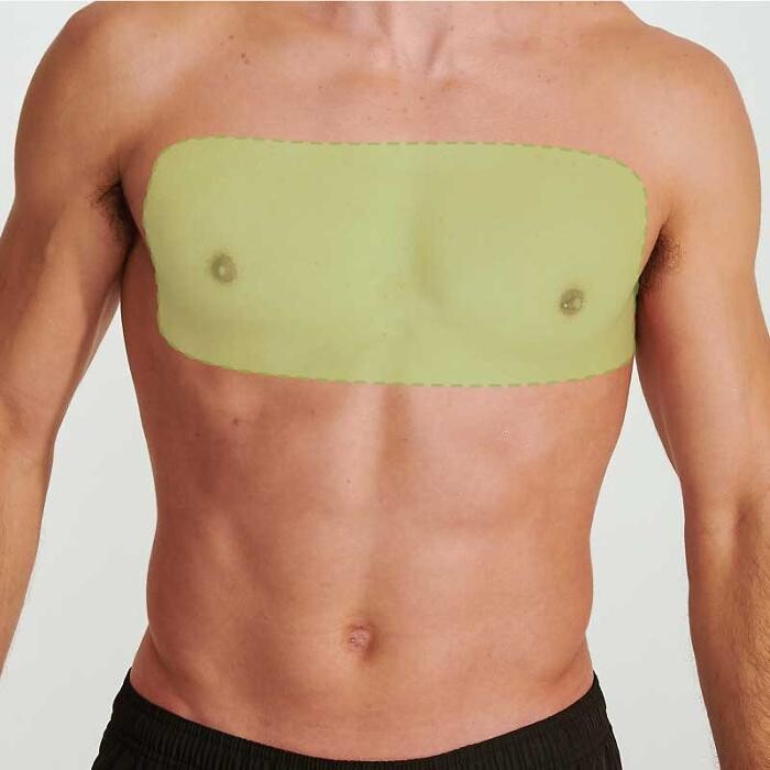 Images Results Laser Clinic Blacktown