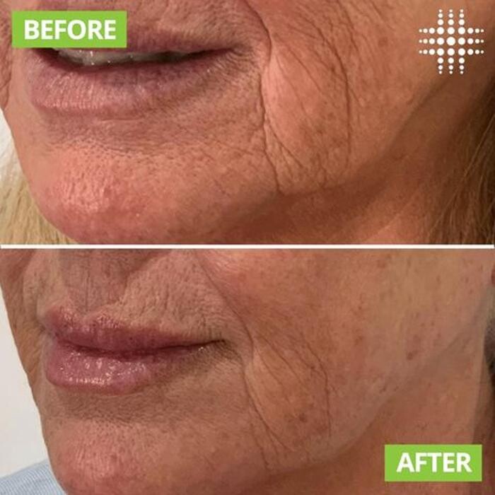 Images Results Laser Clinic Blacktown